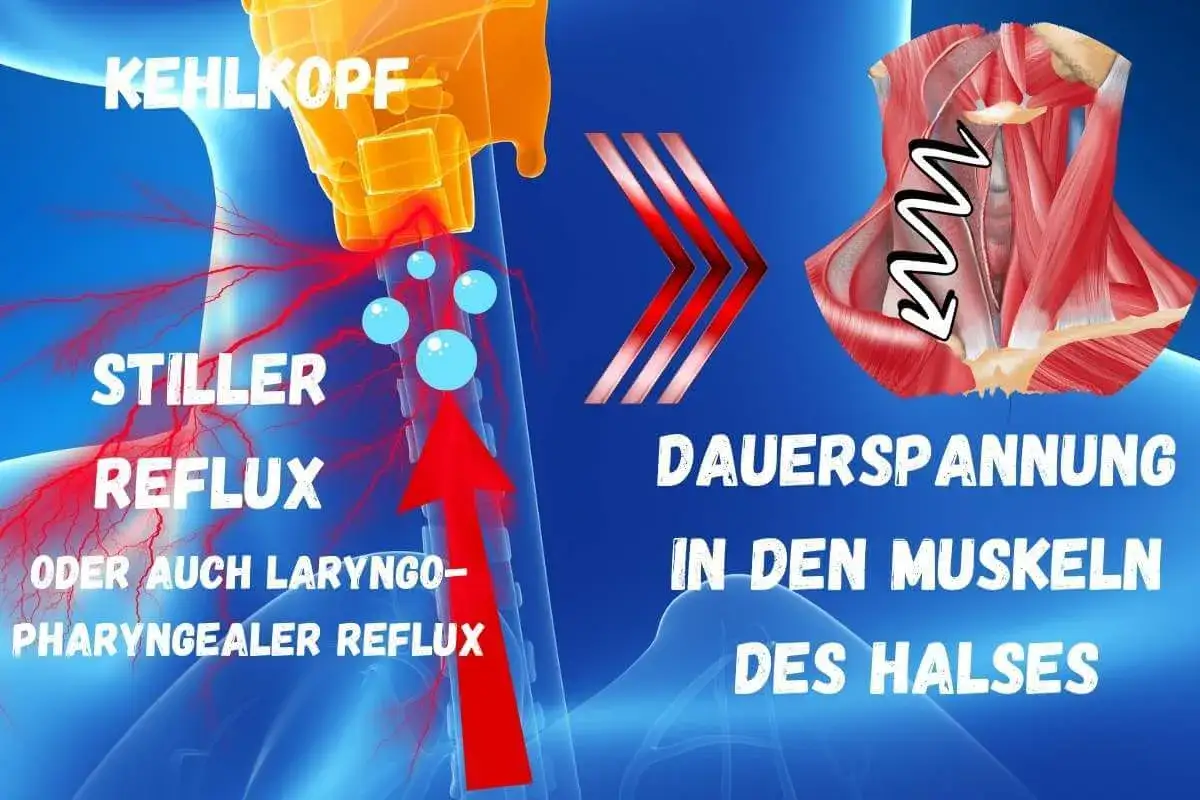 Stiller Reflux kann zu schluckbeschwerden durch verspannungen im Hals f&uuml;hren. Die Grafik zeigt den Kehlkopf und die Muskeln des Halses.